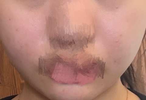 한달동안 피부 뒤집어진거 복구함