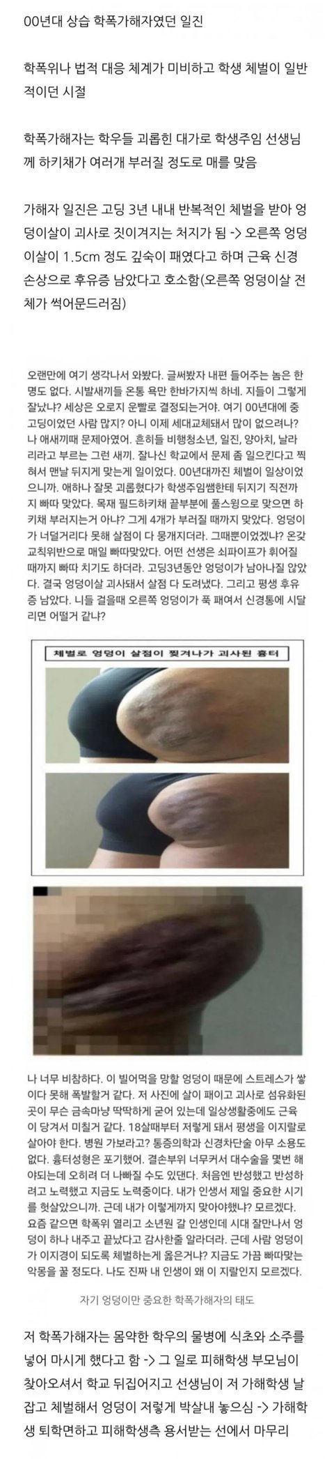 20년전 학교 태형(?)에 처해진 학폭가해자