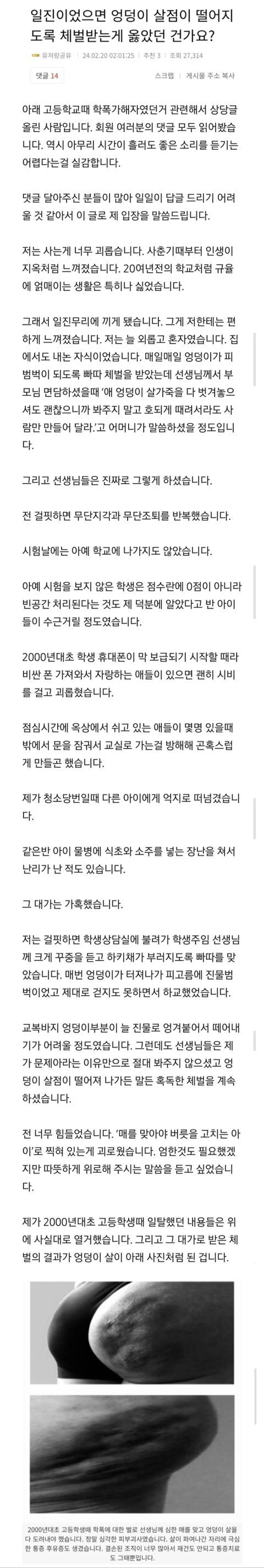 20년전 학교 태형(?)에 처해진 학폭가해자