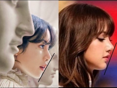 엥 리사 코 성형 새로함 - 1