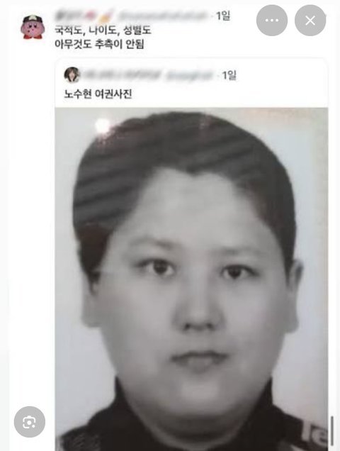 나 사각턱보톡스 100유닛 맞음