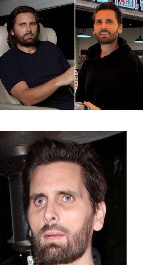 오젬픽 부작용 들어봤어? 해골형되는거?