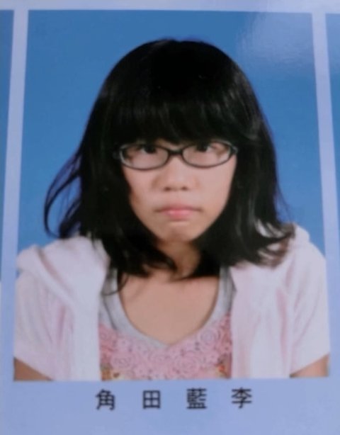 최근 성형전후 레전드