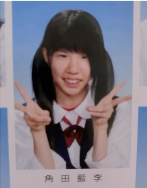 최근 성형전후 레전드