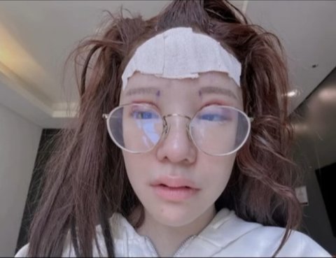 최근 성형전후 레전드