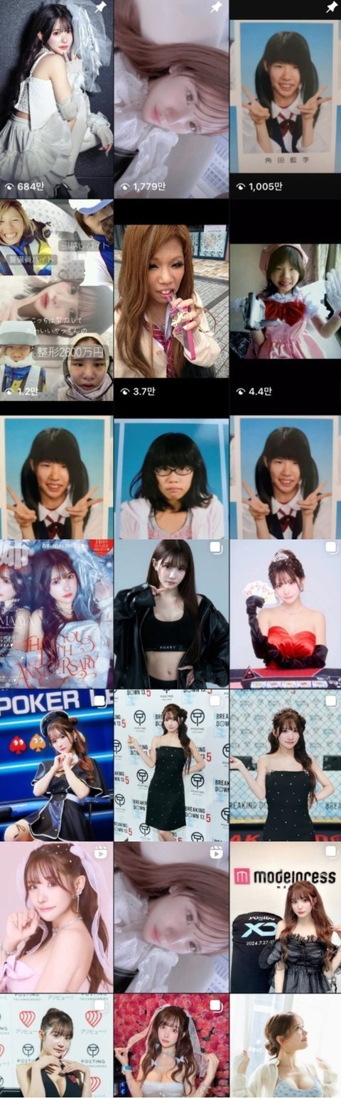 최근 성형전후 레전드